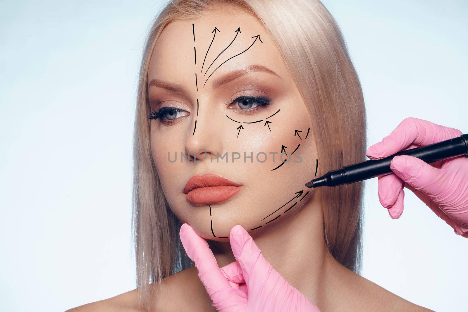 Beautiful blonde woman with markings for plastic surgery on her face, woman portrait