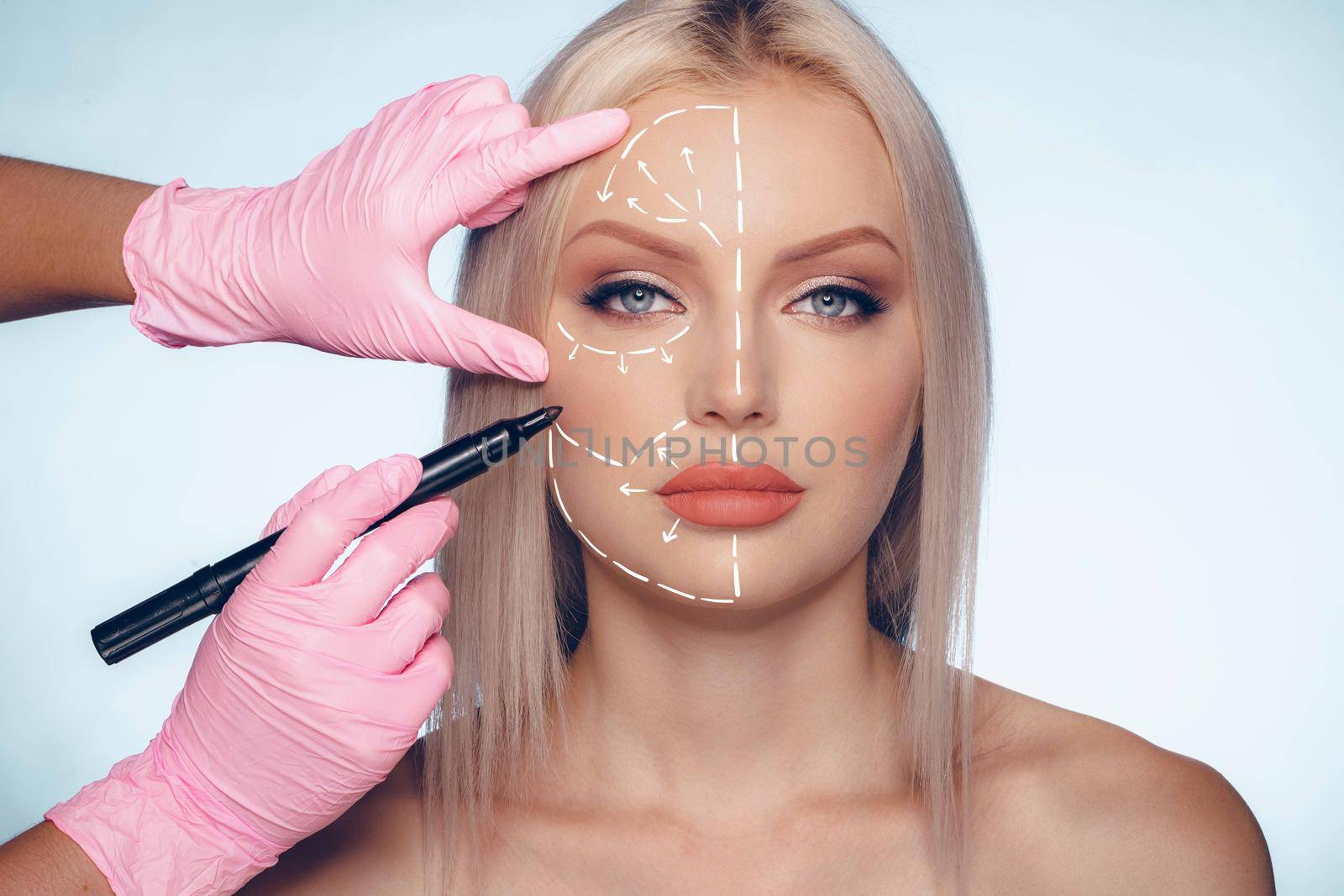 Beautiful blonde woman with markings for plastic surgery on her face, woman portrait