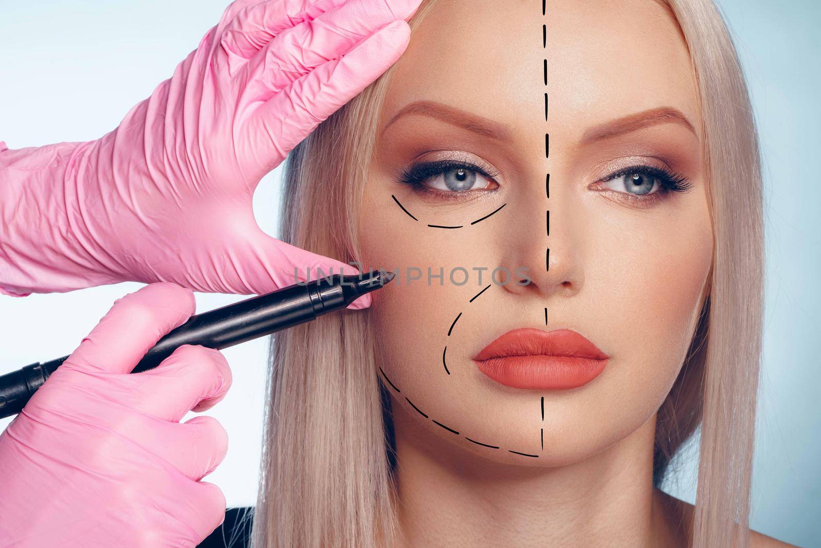 Beautiful blonde woman with markings for plastic surgery on her face by Fabrikasimf