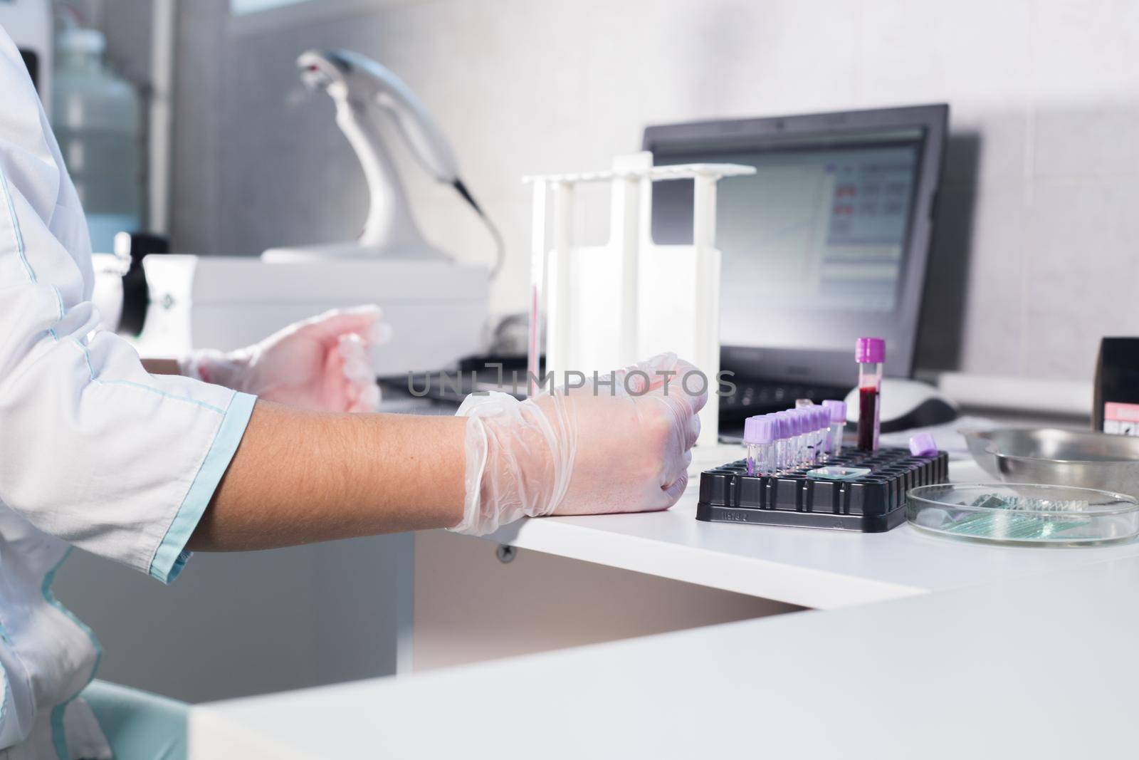 Medical clinic. Nurse at her workplace making a bloodtest. Close up