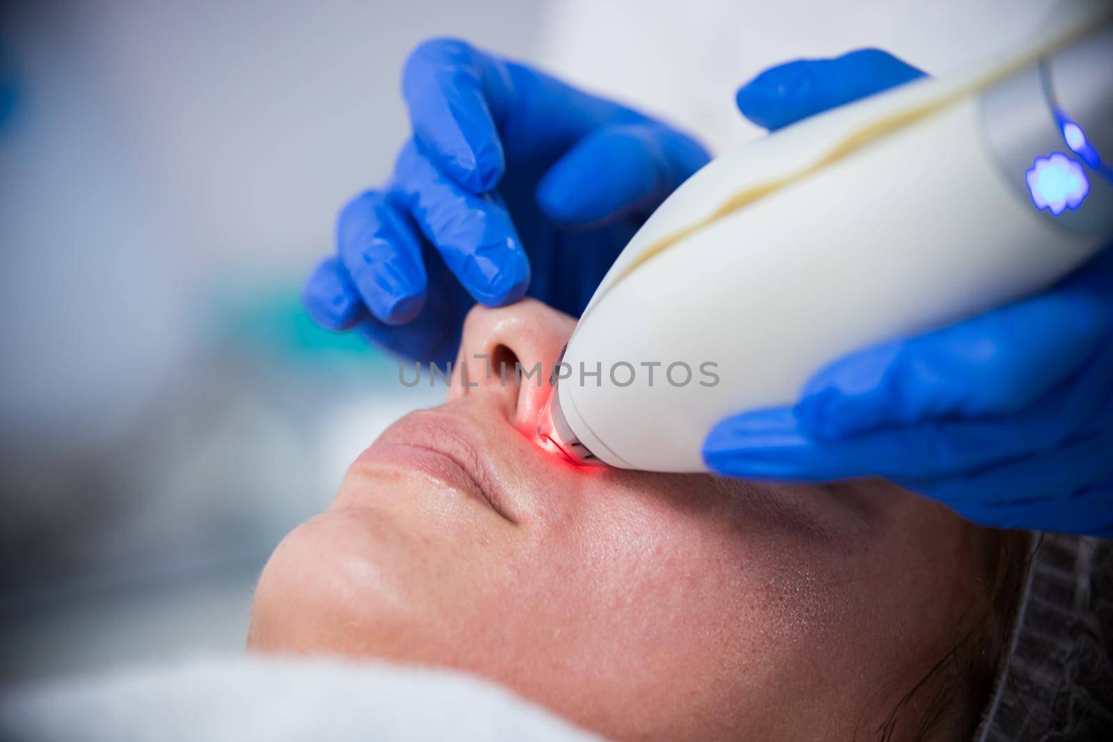 Cosmetology clinic. Pore cleansing procedure. A cosmetologist working with a tool. Nose cleansing. Close up