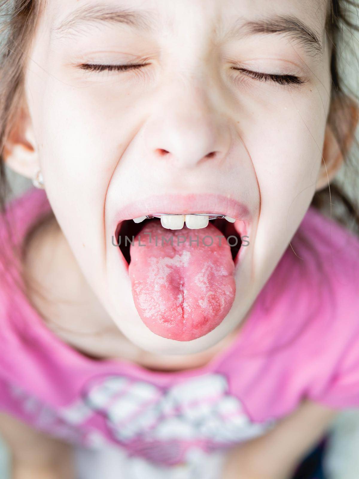 A child at the doctor. The doctor examines the throat of a child.