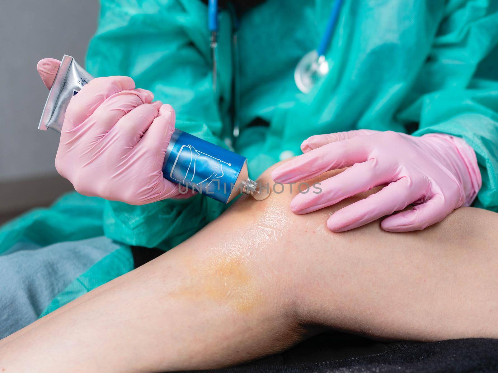 Close-up Applying a healing ointment to a bruise on the leg. Family doctor examines leg injury by Utlanov