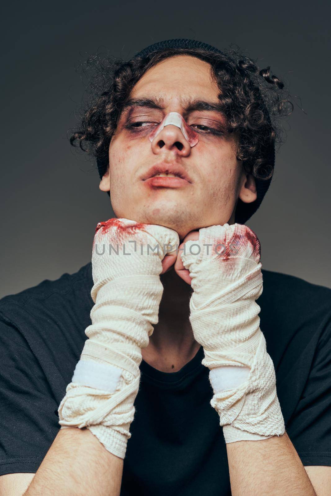 fighter with broken nose training boxing conflict aggression injury. High quality photo