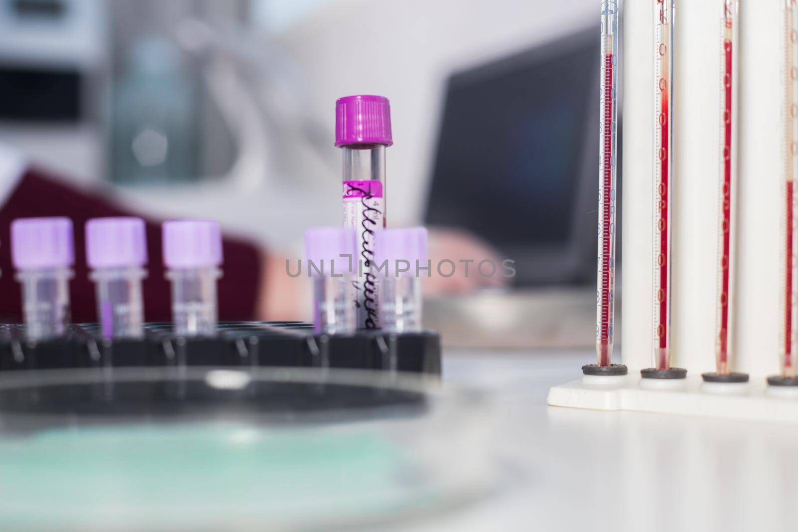 Medical clinic. A stand with pipettes filled with blood standing near the sample tubes. Tube close up shot