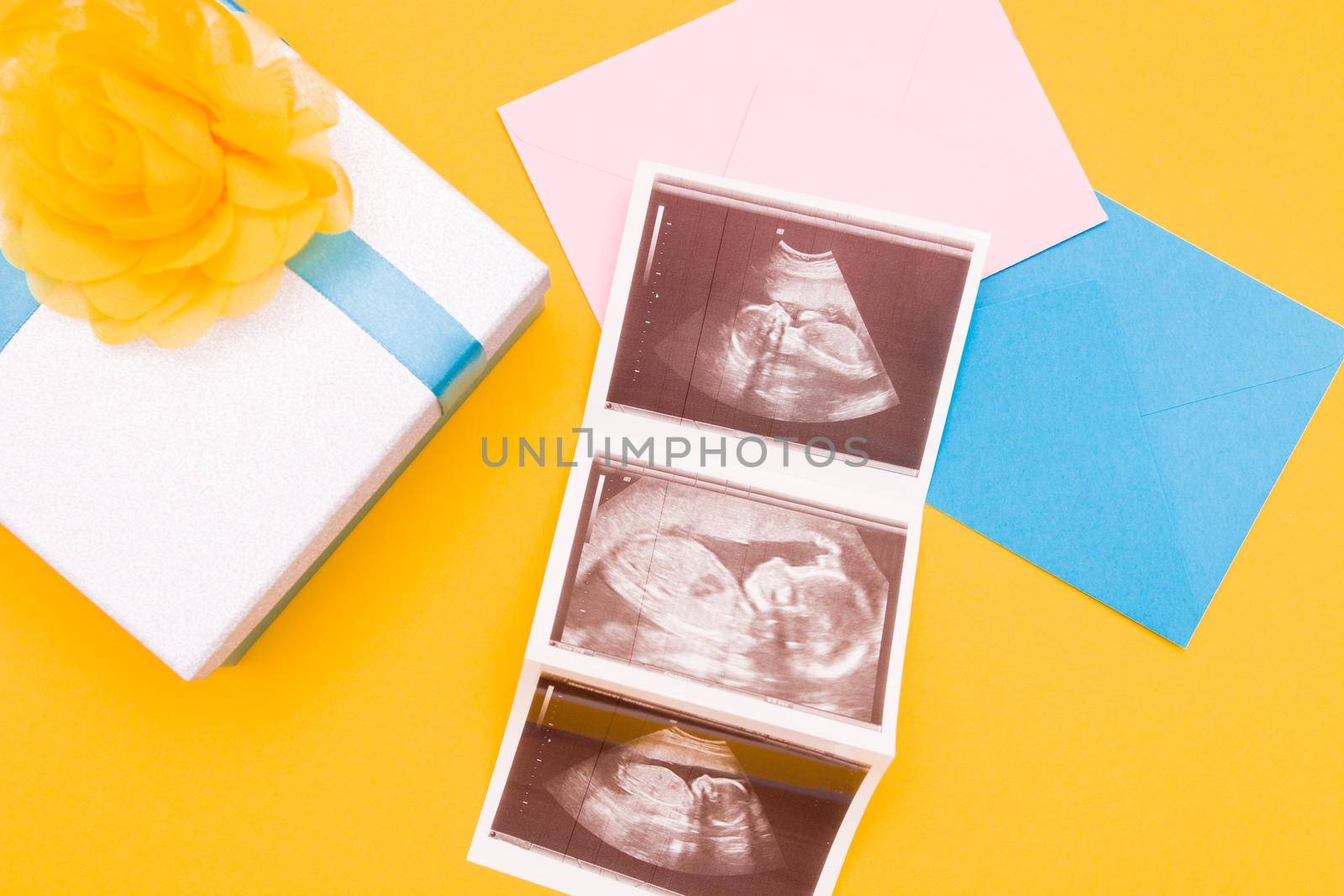 ultrasound picture in a silver box with a blue ribbon and yellow flower yellow background place copy top view, woman pregnant with boy or girl, surprise, photo as a gift, pregnancy concept