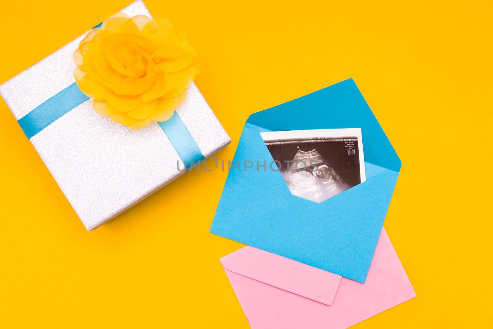 ultrasound picture in a silver box with a blue ribbon and yellow flower yellow background place copy top view, woman pregnant with boy or girl, surprise, photo as a gift, pregnancy concept by natashko