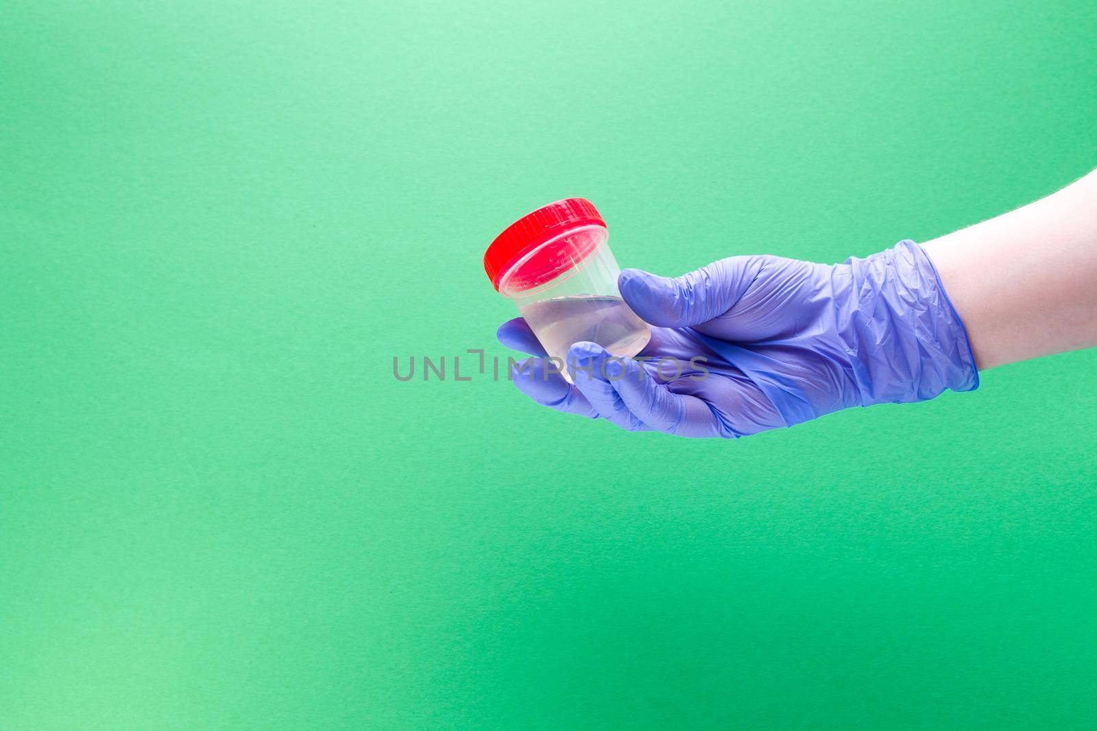 hand in a disposable medical glove holds a jar for analysis with urine, green background, copy space