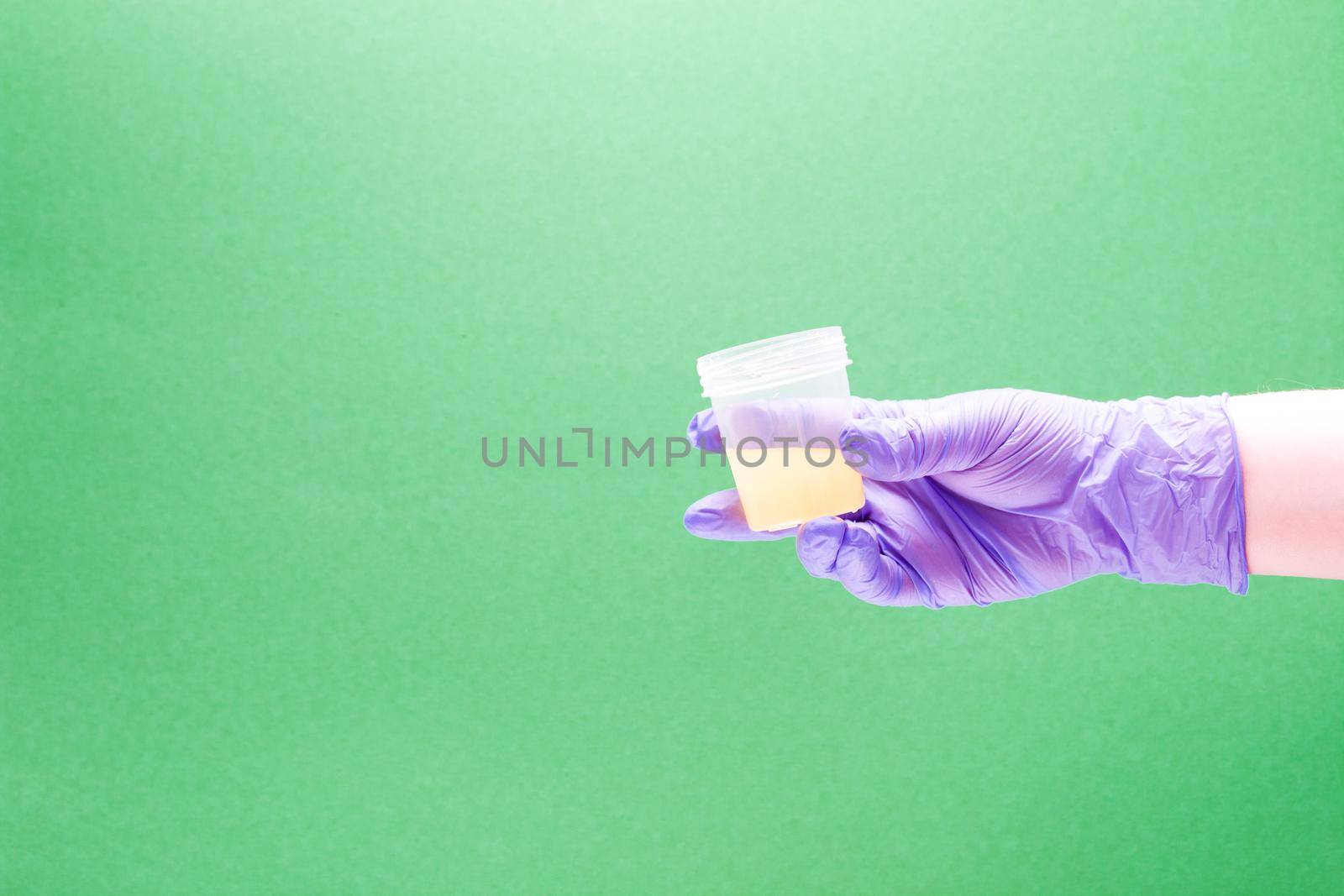 female hand in blue disposable glove holds a test jar with yellow liquid, green background, copy space by natashko