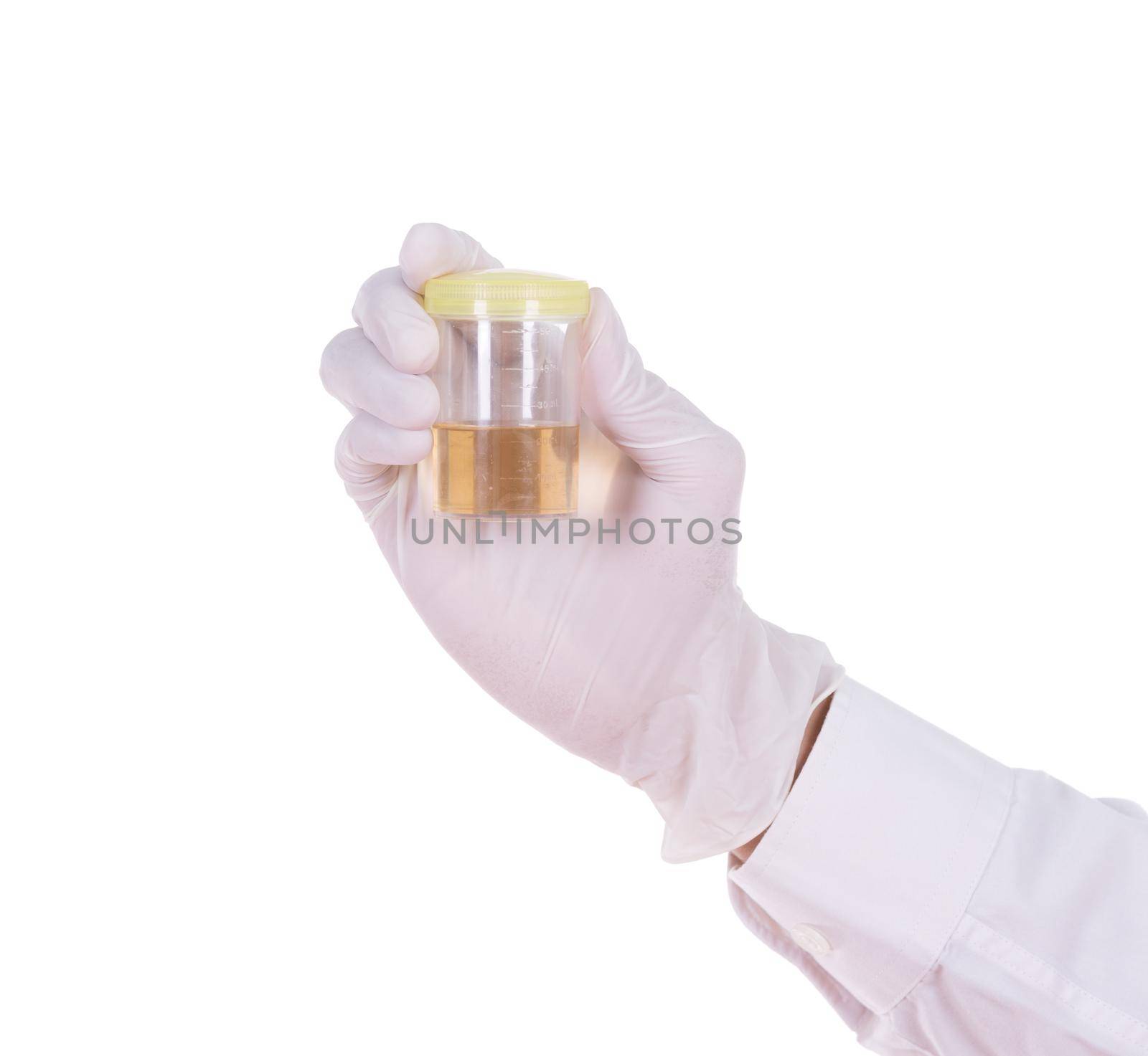 doctor's hand in gloves holding a transparent container with the analysis of urine  by geargodz