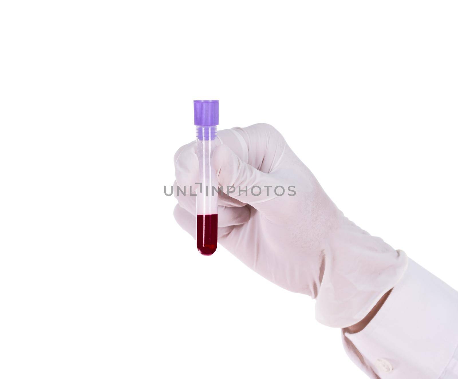 Hand holding test tube with blood by geargodz