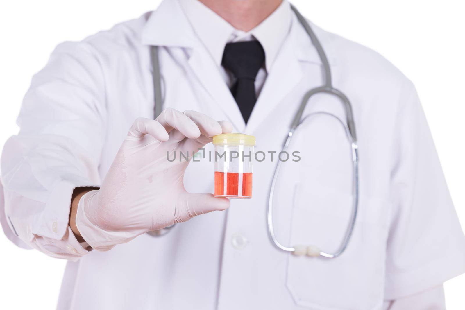 doctor's hand holding a bottle of bloody urine sample isolated on white background