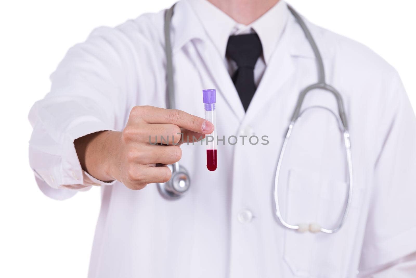 close up a medical test glass with blood with doctor