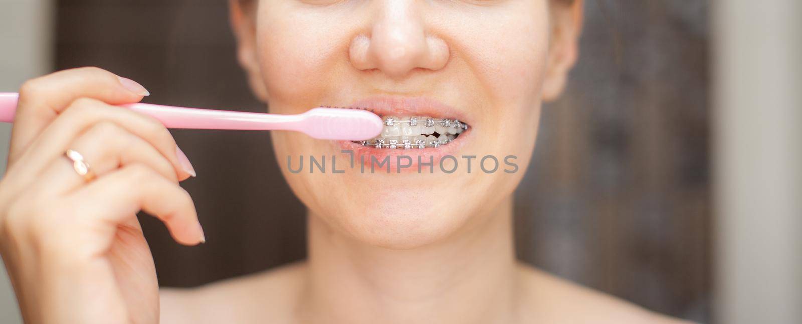 Girl with braces on her teeth brushing her teeth with a toothbrush by AnatoliiFoto