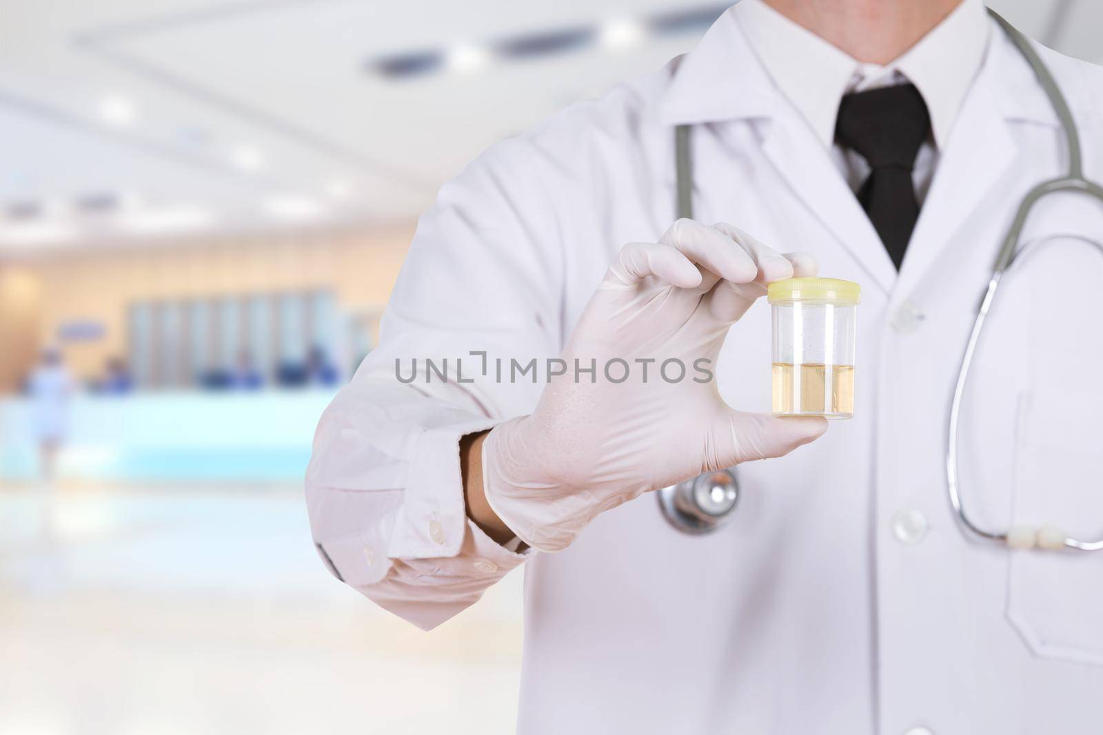 doctor's hand holding a bottle of urine sample in hospital background