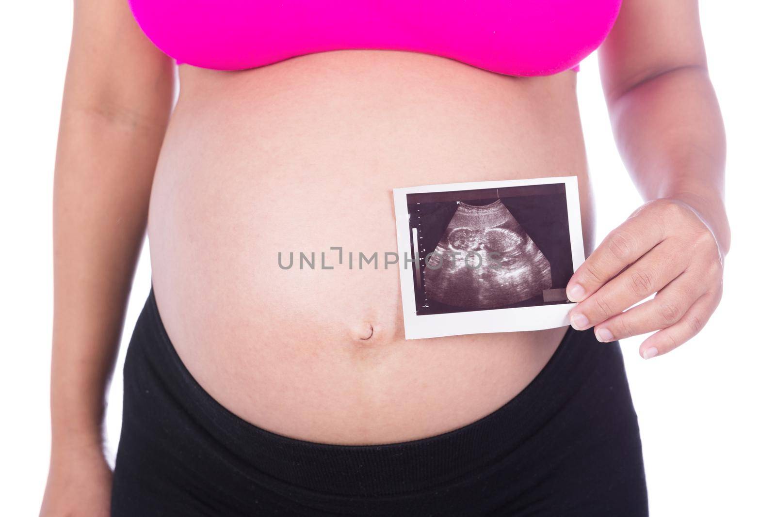 Pregnant woman hands holding ultrasound photo on white background by geargodz