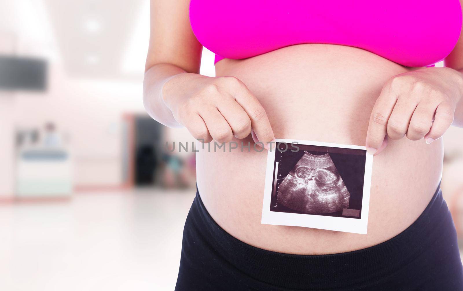Pregnant woman hands holding ultrasound photo isolated in hospital background