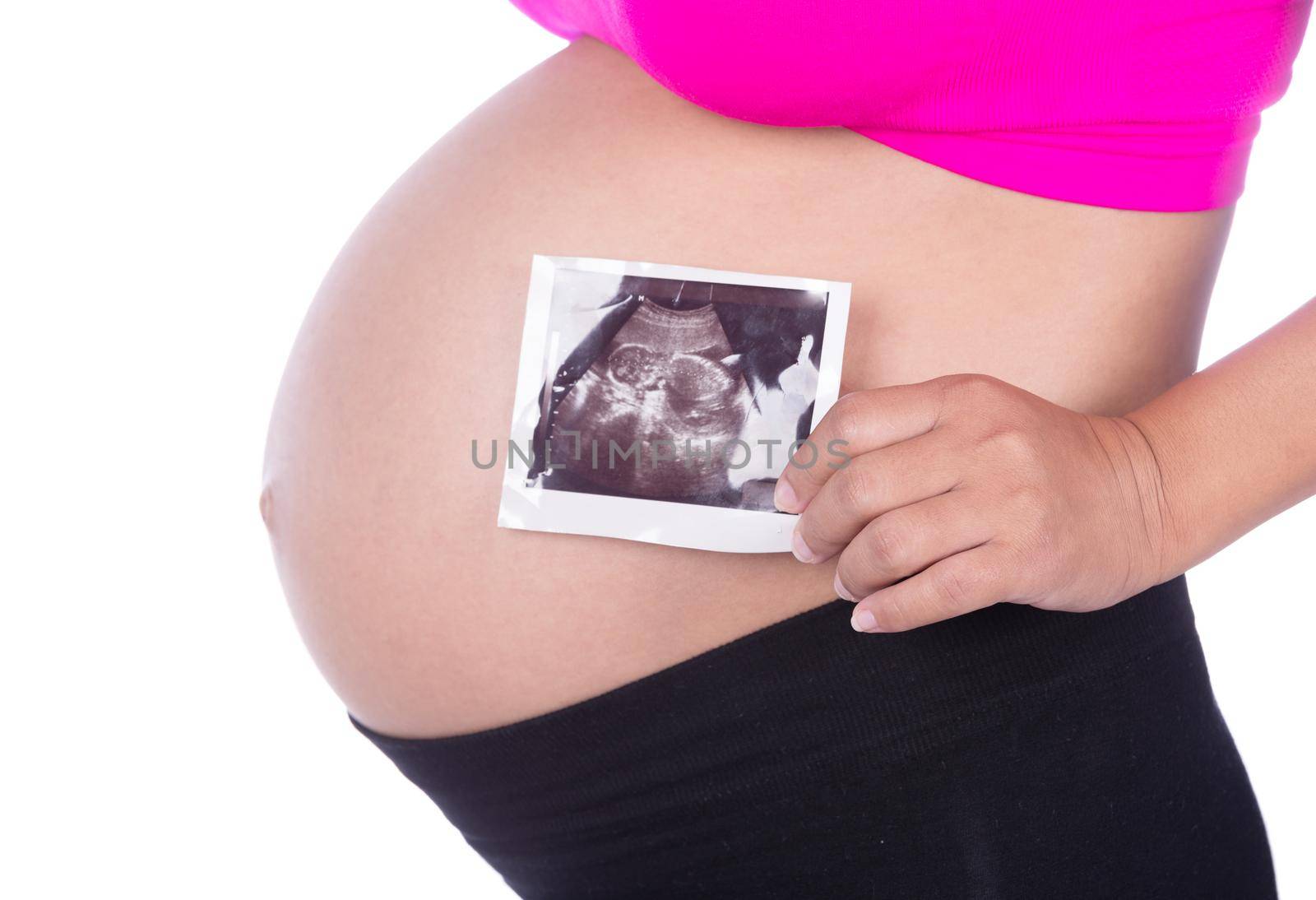 Pregnant woman hands holding ultrasound photo on white background by geargodz