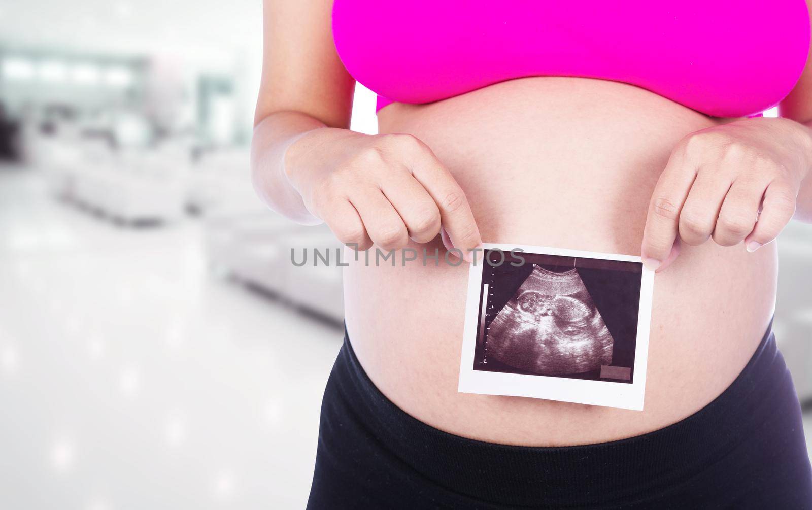 Pregnant woman hands holding ultrasound photo isolated in hospital background