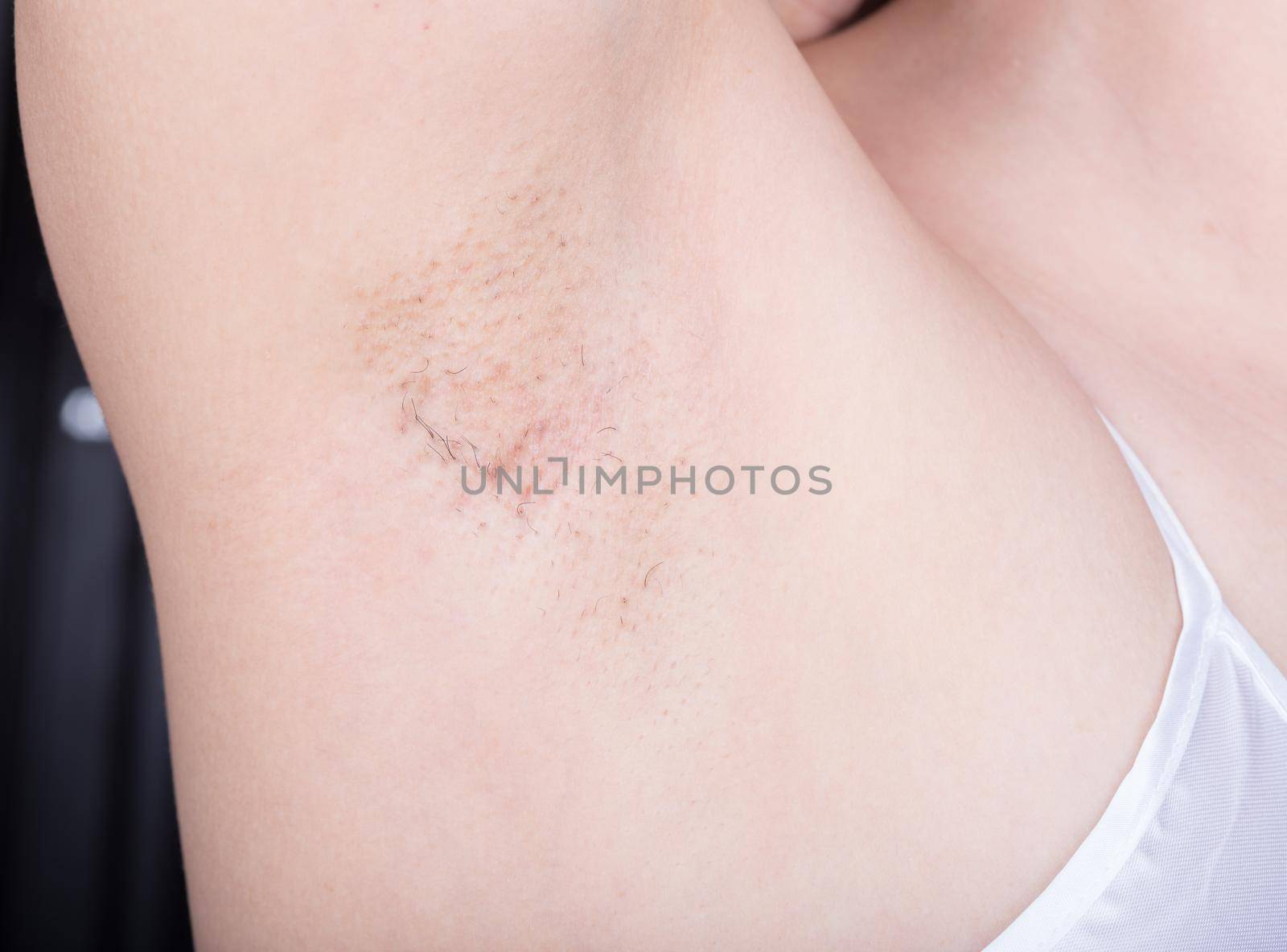 armpit of woman with grown hair