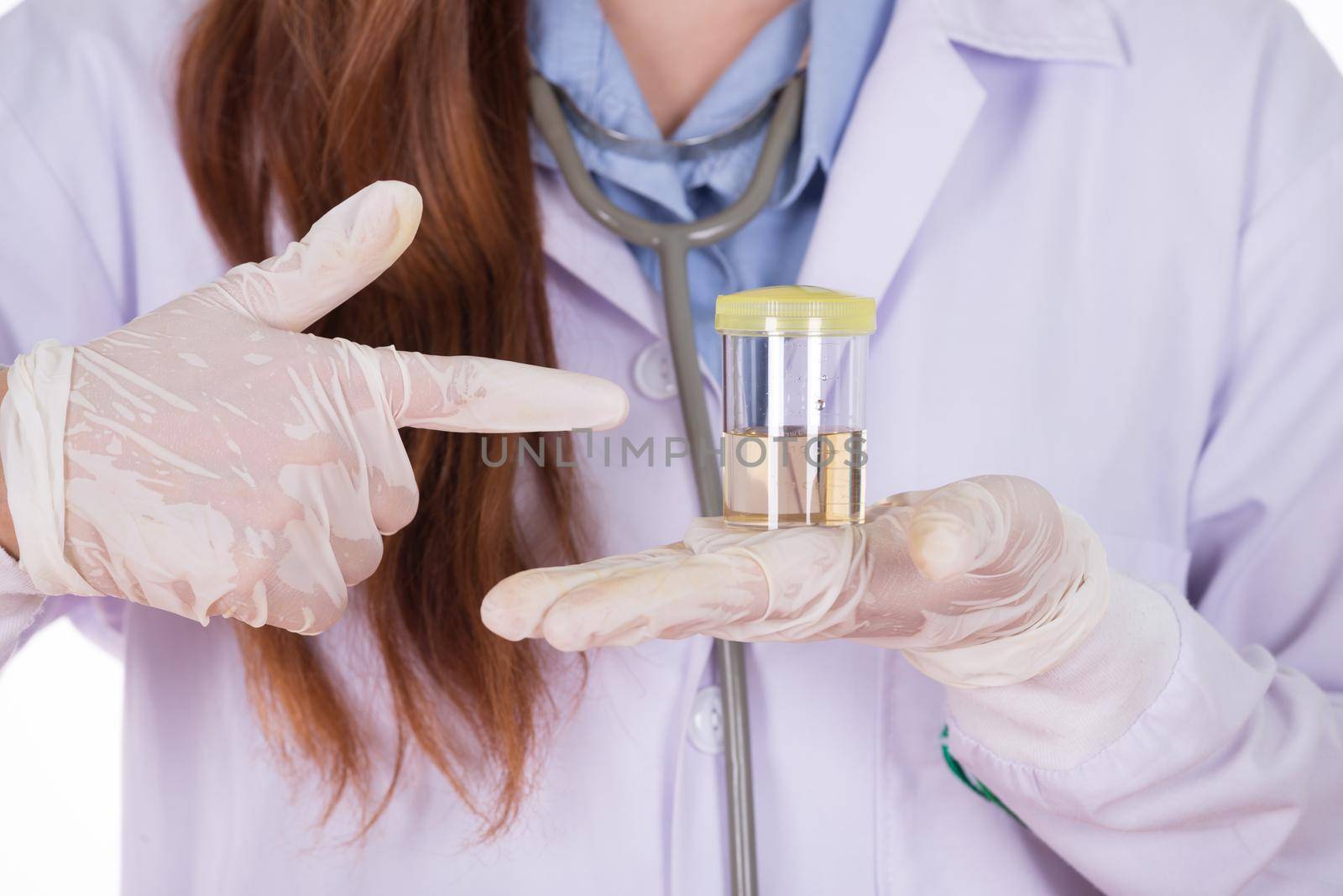 female doctor's hand holding a bottle of urine sample 
