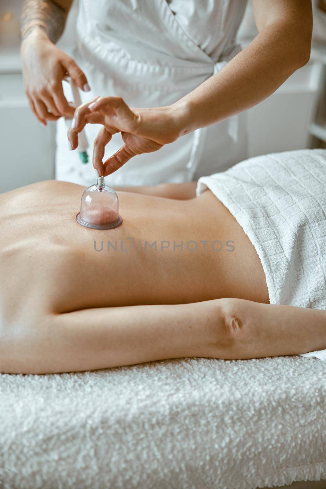 professional female specialist is doing cupping therapy on the back of beautiful caucasian lady