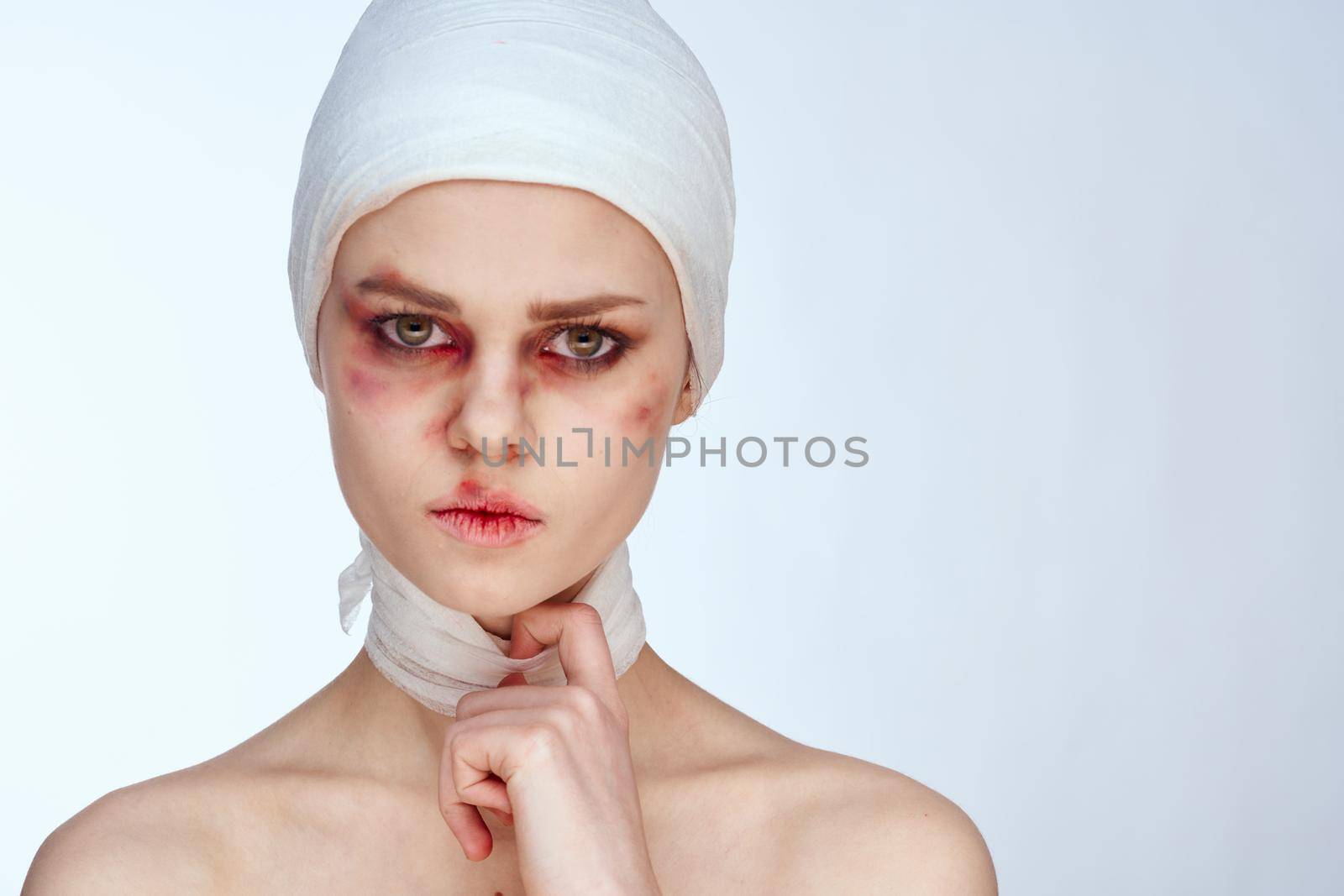 woman facial injury health problems bruises pain isolated background by Vichizh