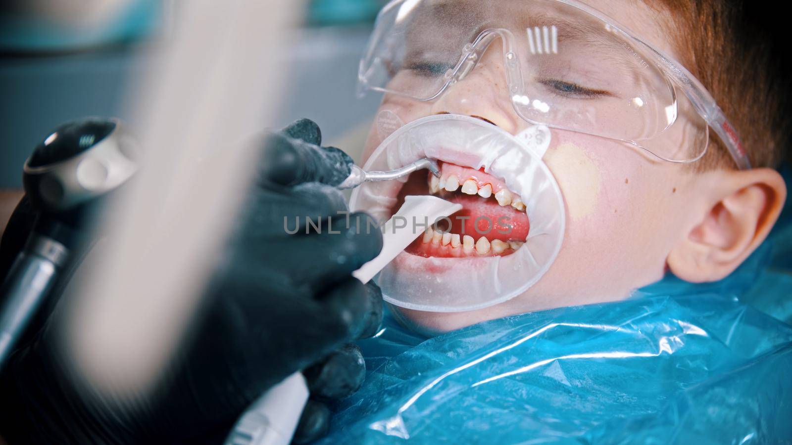 A little boy having a cleaning treatment in the modern dentistry. Mid shot