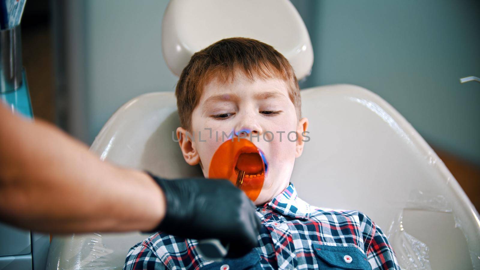 A little boy having his tooth done - putting the photopolymer lamp in the mouth by Studia72