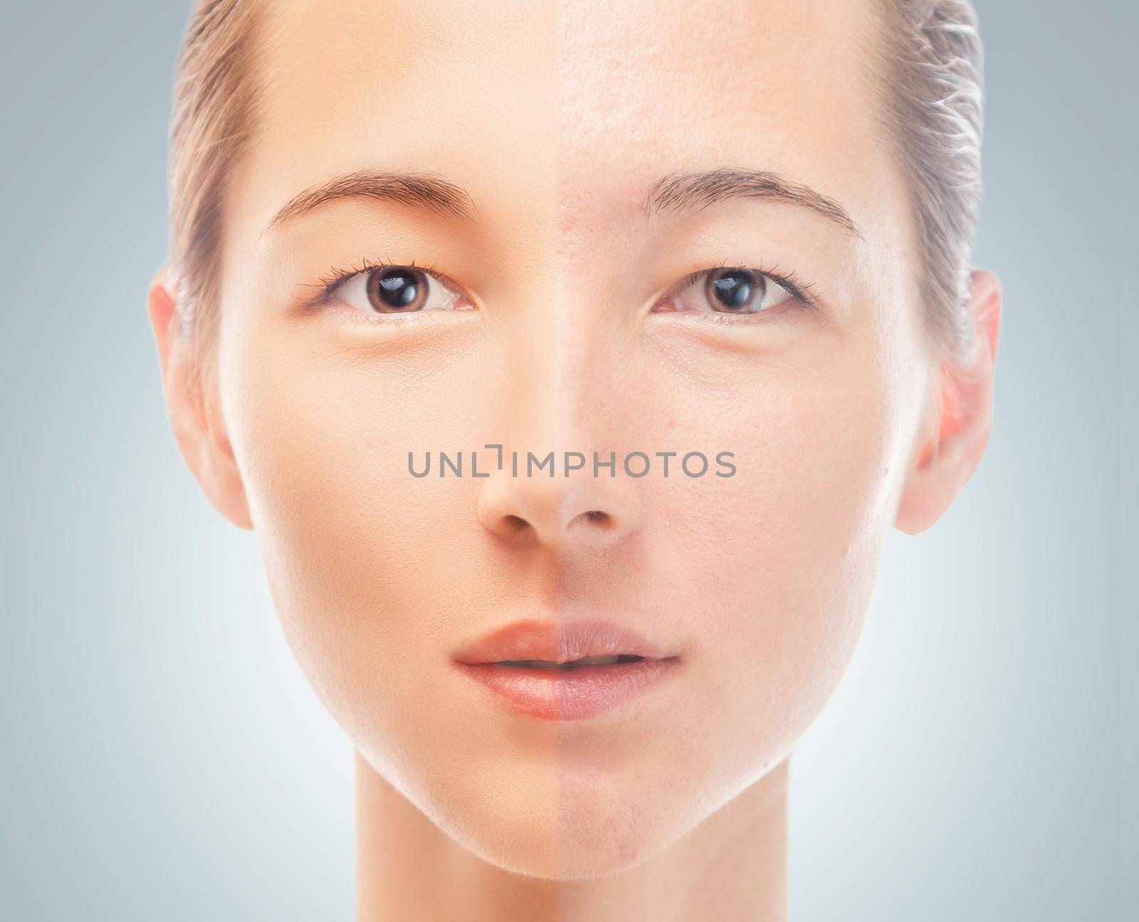 Skin of young woman before and after the cosmetics procedure, problem and smooth skin, concept of skincare