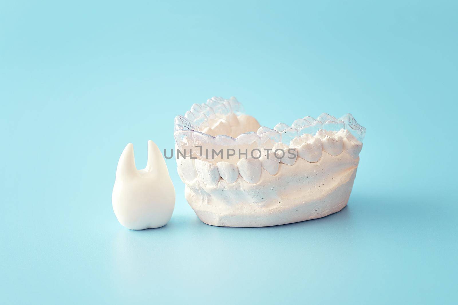 Orthodontic dental theme on blue  background.Transparent invisible dental aligners or braces aplicable for an orthodontic dental treatment by Maximusnd