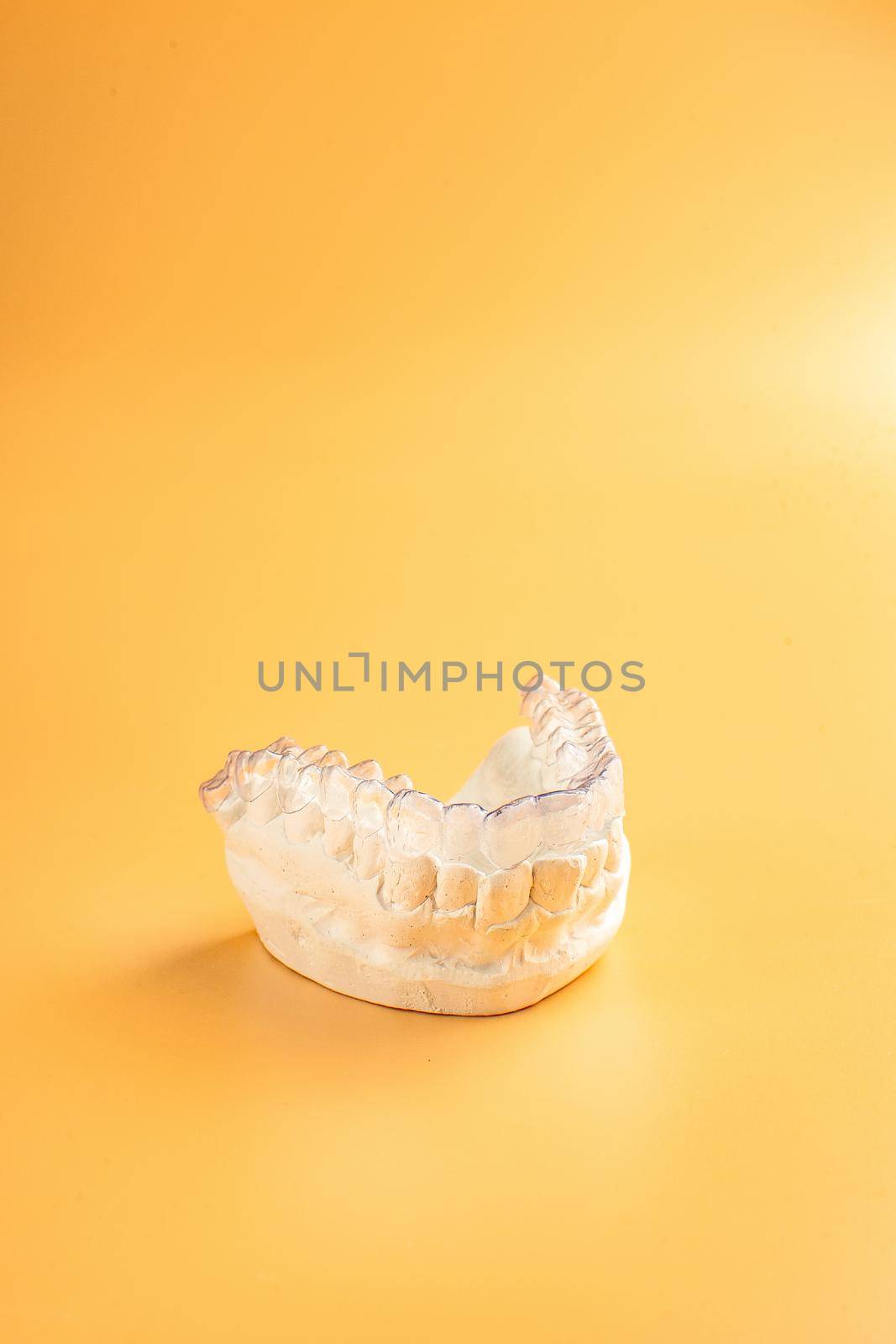 Inivisalign braces or aligner. A way to have a beautiful smile and white teeth.Invisible Invisalign plastic dental teeth brackets by Maximusnd