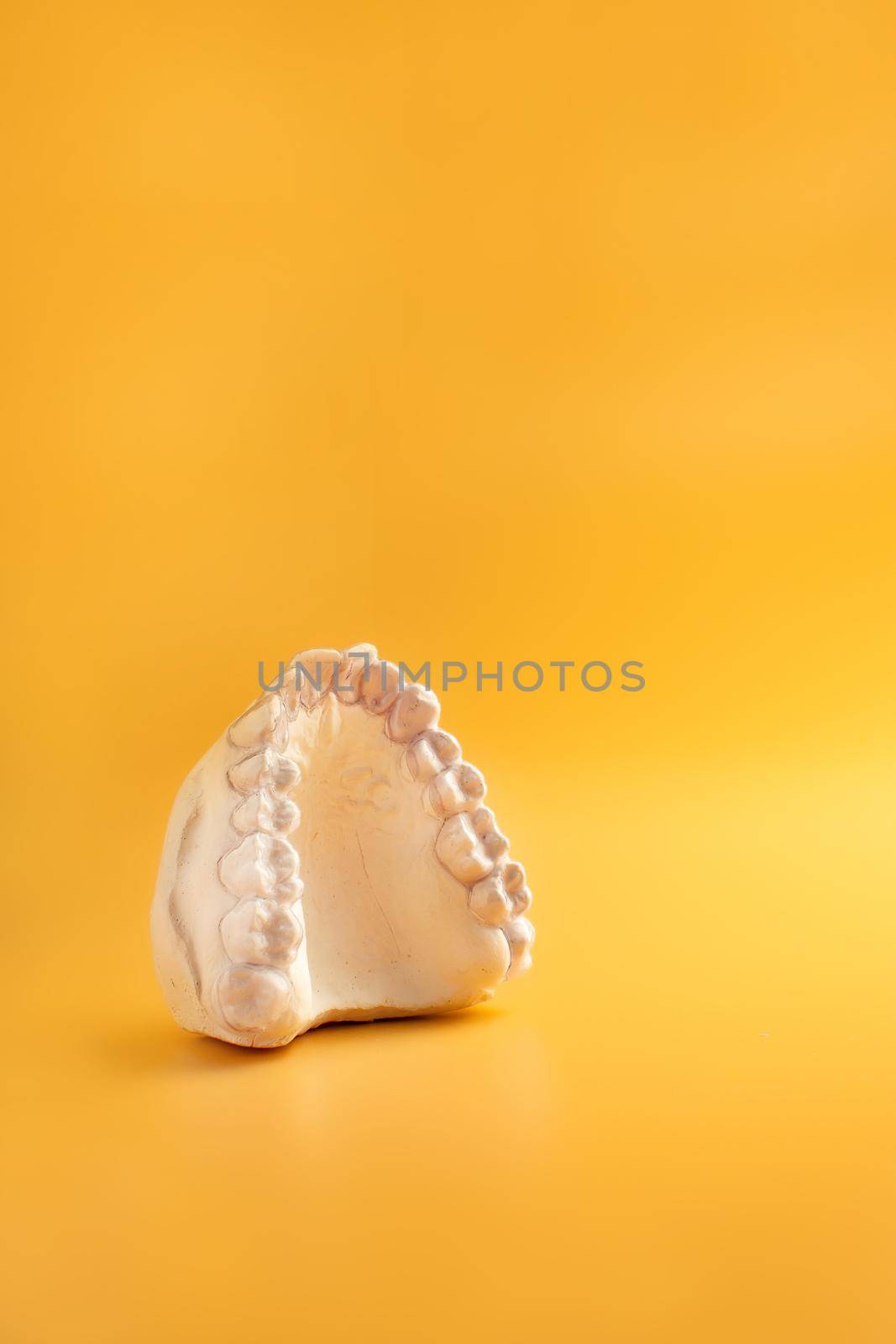 Inivisalign braces or aligner. A way to have a beautiful smile and white teeth.Invisible Invisalign plastic dental teeth brackets by Maximusnd