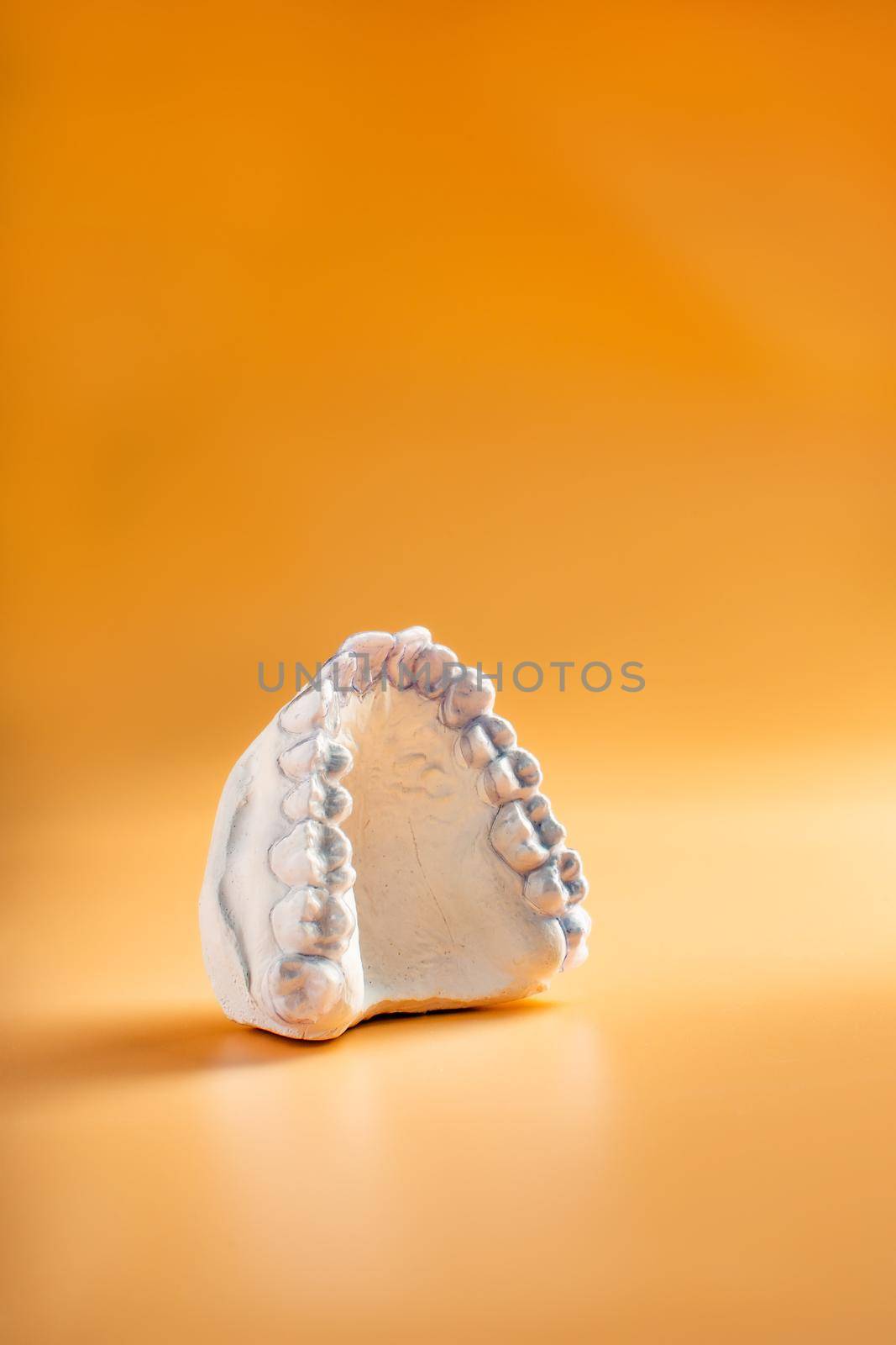 Inivisalign braces or aligner. A way to have a beautiful smile and white teeth.Invisible Invisalign plastic dental teeth brackets by Maximusnd