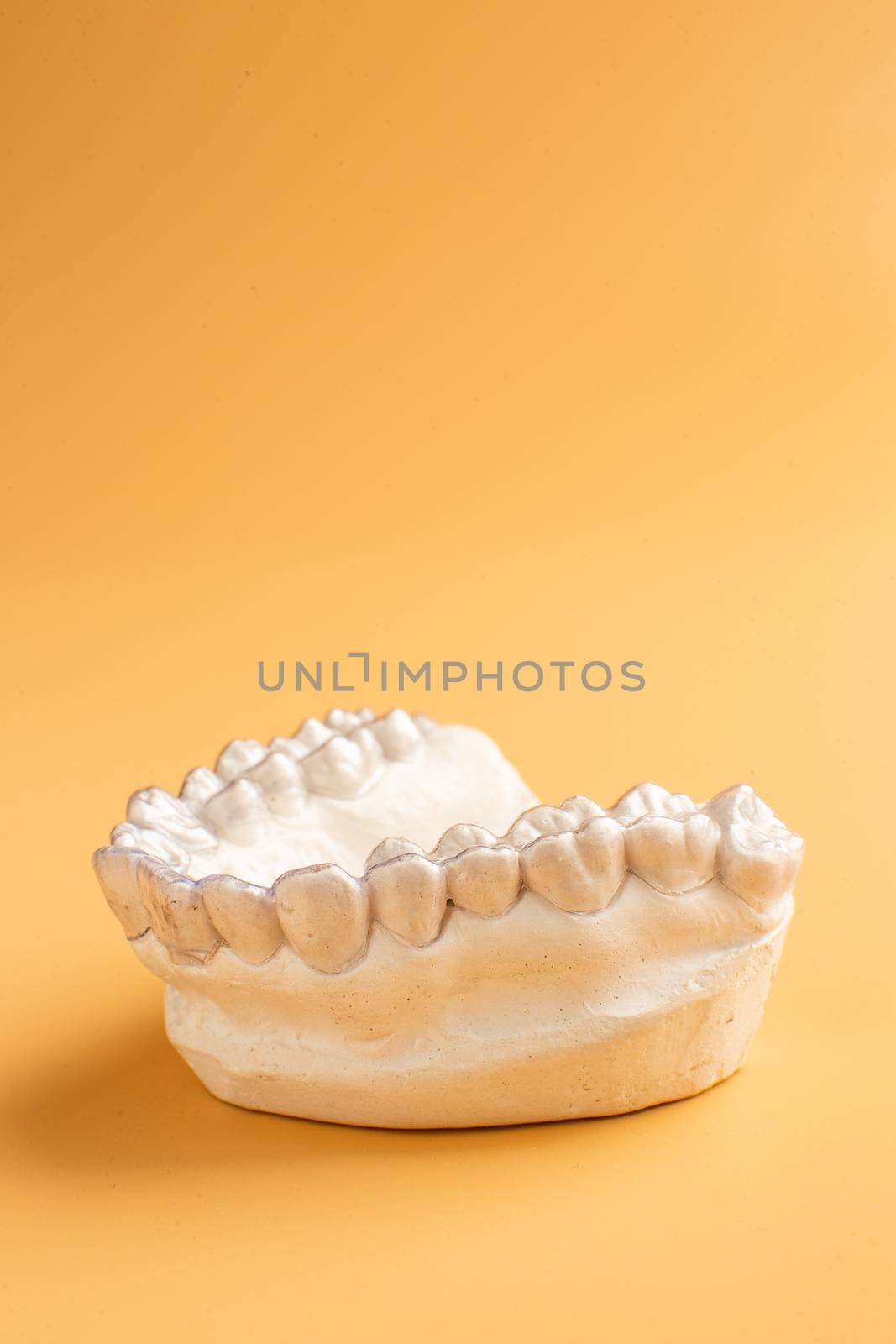 Close-up individual tooth tray Orthodontic dental theme. In hand Invisible braces