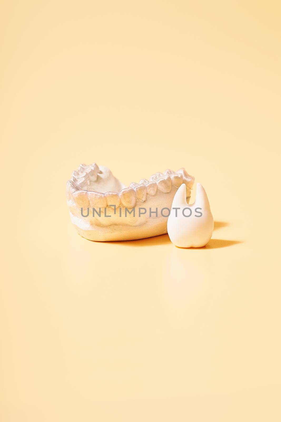 Orthodontic dental theme on  yellow background.Transparent invisible dental aligners or braces aplicable for an orthodontic dental treatment by Maximusnd