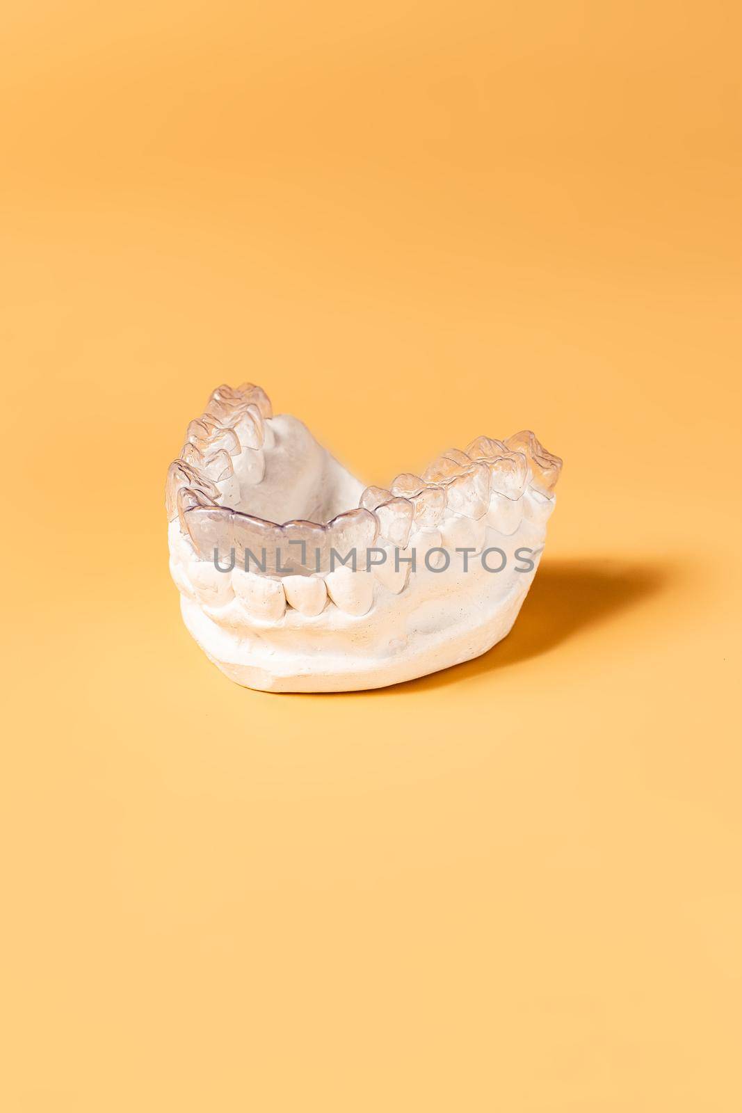 Close-up individual tooth tray Orthodontic dental theme. In hand Invisible braces