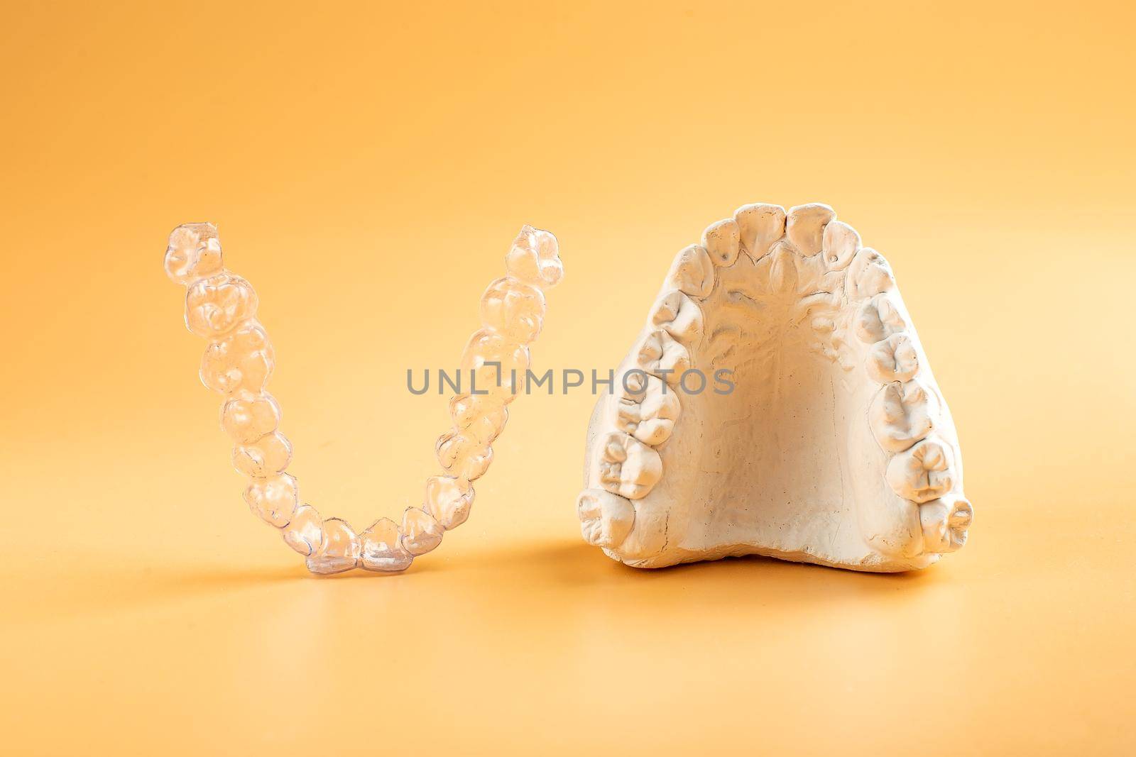 Close-up individual tooth tray Orthodontic dental theme. In hand Invisible braces by Maximusnd