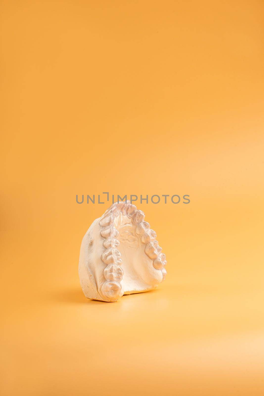 Inivisalign braces or aligner. A way to have a beautiful smile and white teeth.Invisible Invisalign plastic dental teeth brackets by Maximusnd