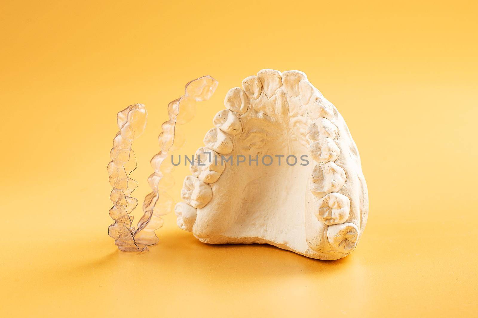 Close-up individual tooth tray Orthodontic dental theme. In hand Invisible braces by Maximusnd