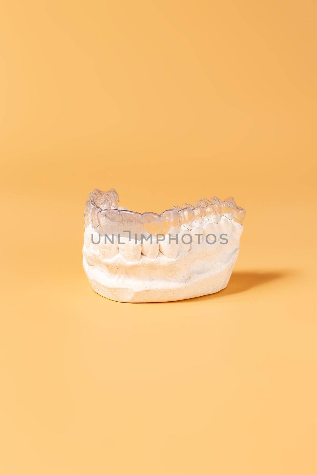 Close-up individual tooth tray Orthodontic dental theme. In hand Invisible braces by Maximusnd