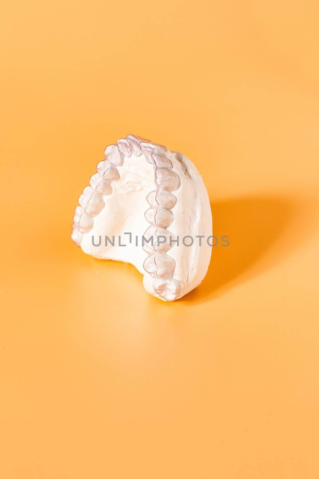 Close-up individual tooth tray Orthodontic dental theme. In hand Invisible braces by Maximusnd