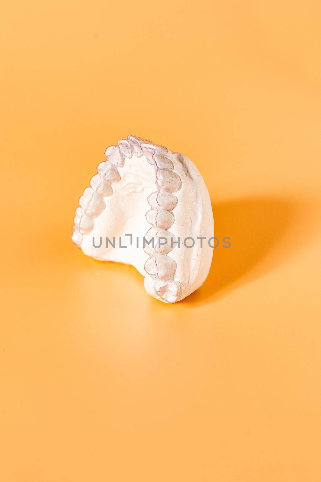 Close-up individual tooth tray Orthodontic dental theme. In hand Invisible braces