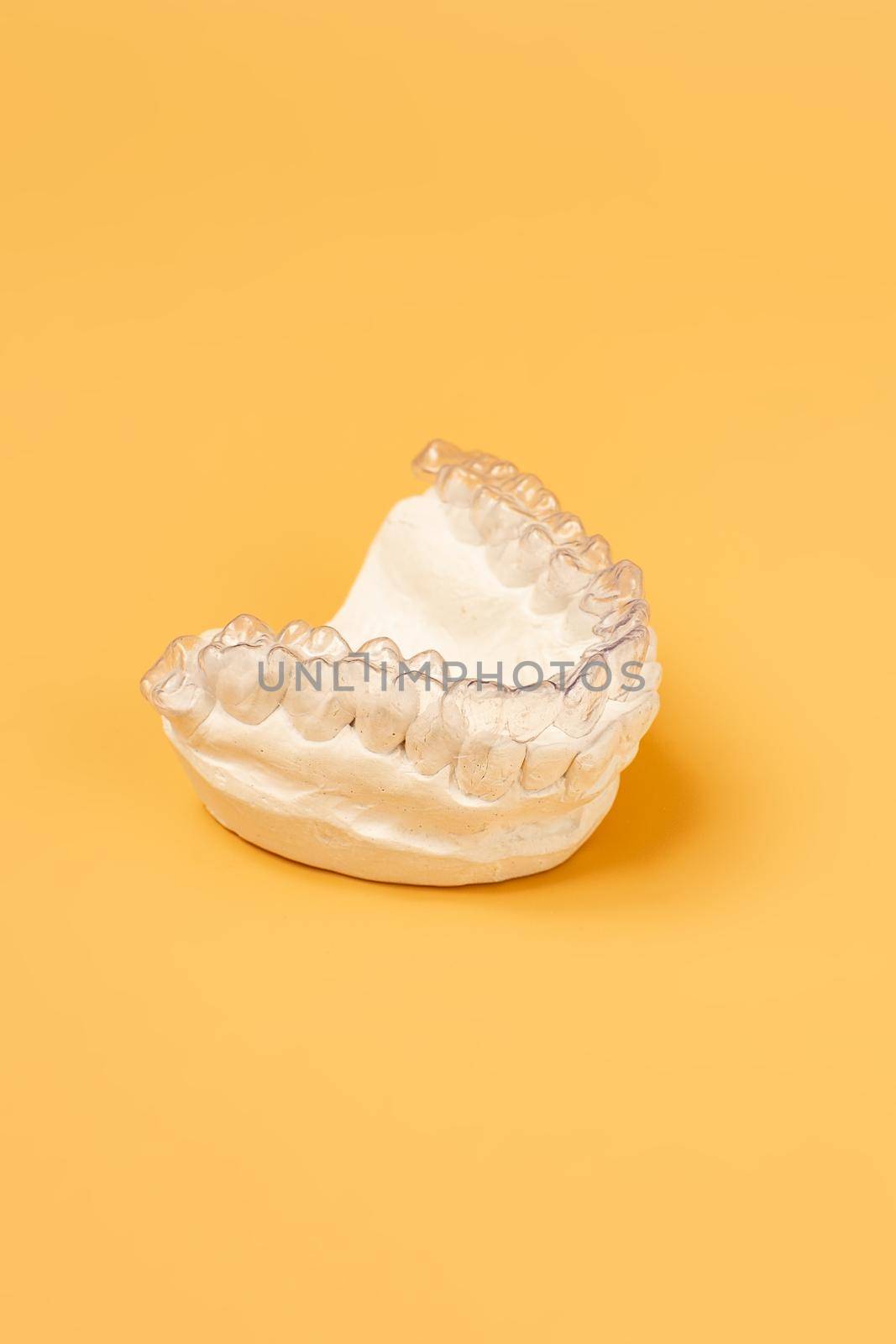 Close-up individual tooth tray Orthodontic dental theme. In hand Invisible braces by Maximusnd