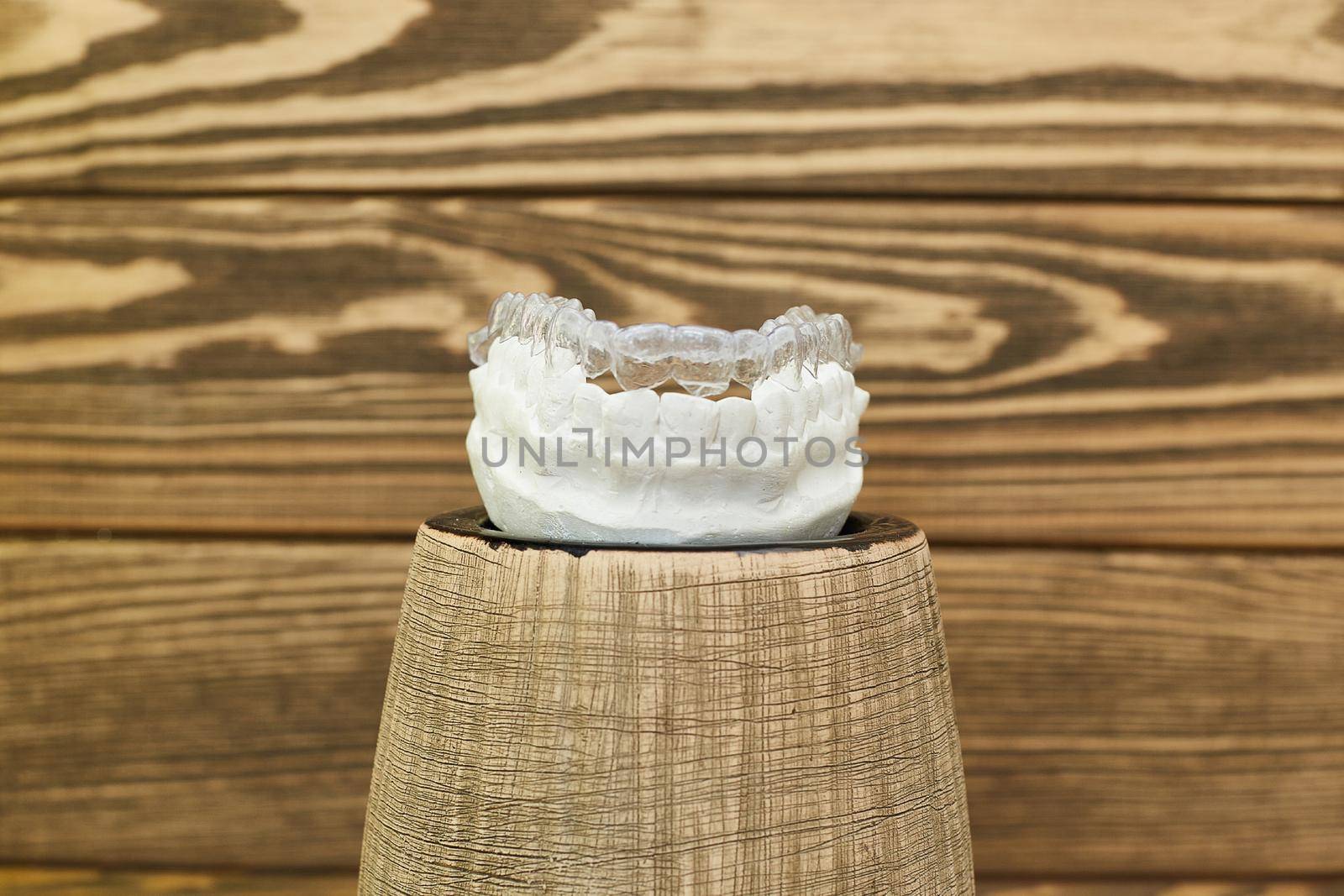 Orthodontic dental theme on a rustic background. Transparent invisible trays or braces for orthodontic dental treatment. by Maximusnd