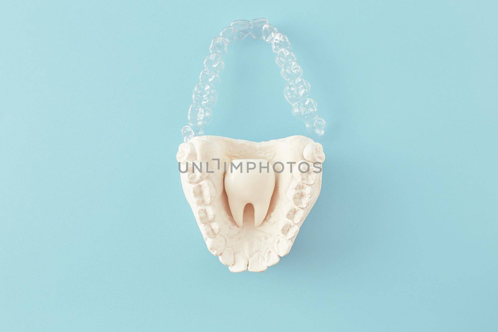 Orthodontic dental theme on blue  background.Transparent invisible dental aligners or braces aplicable for an orthodontic dental treatment