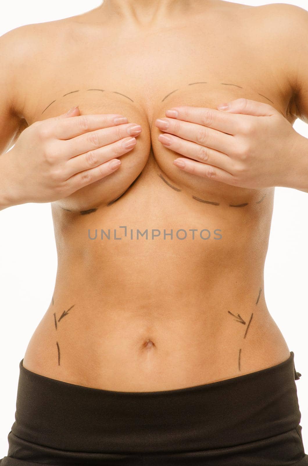 Tits correction. Plastic surgery, isolated, white background.Beautiful Woman Covering Breast With Black Surgical Lines