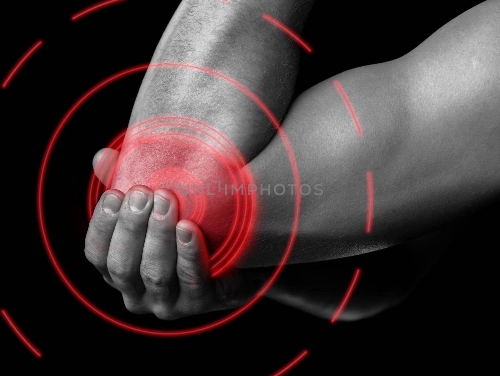 The man is touching the elbow due to acute pain, pain area of red color