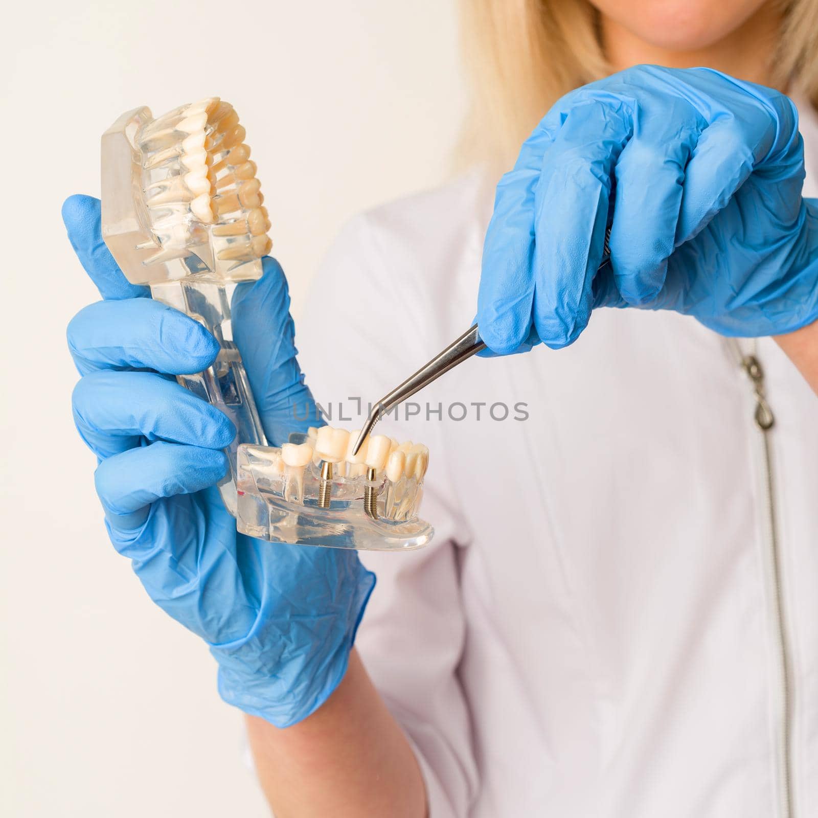 Dentist demonstrates problems with teeth on the example of the layout of the jaw by zartarn
