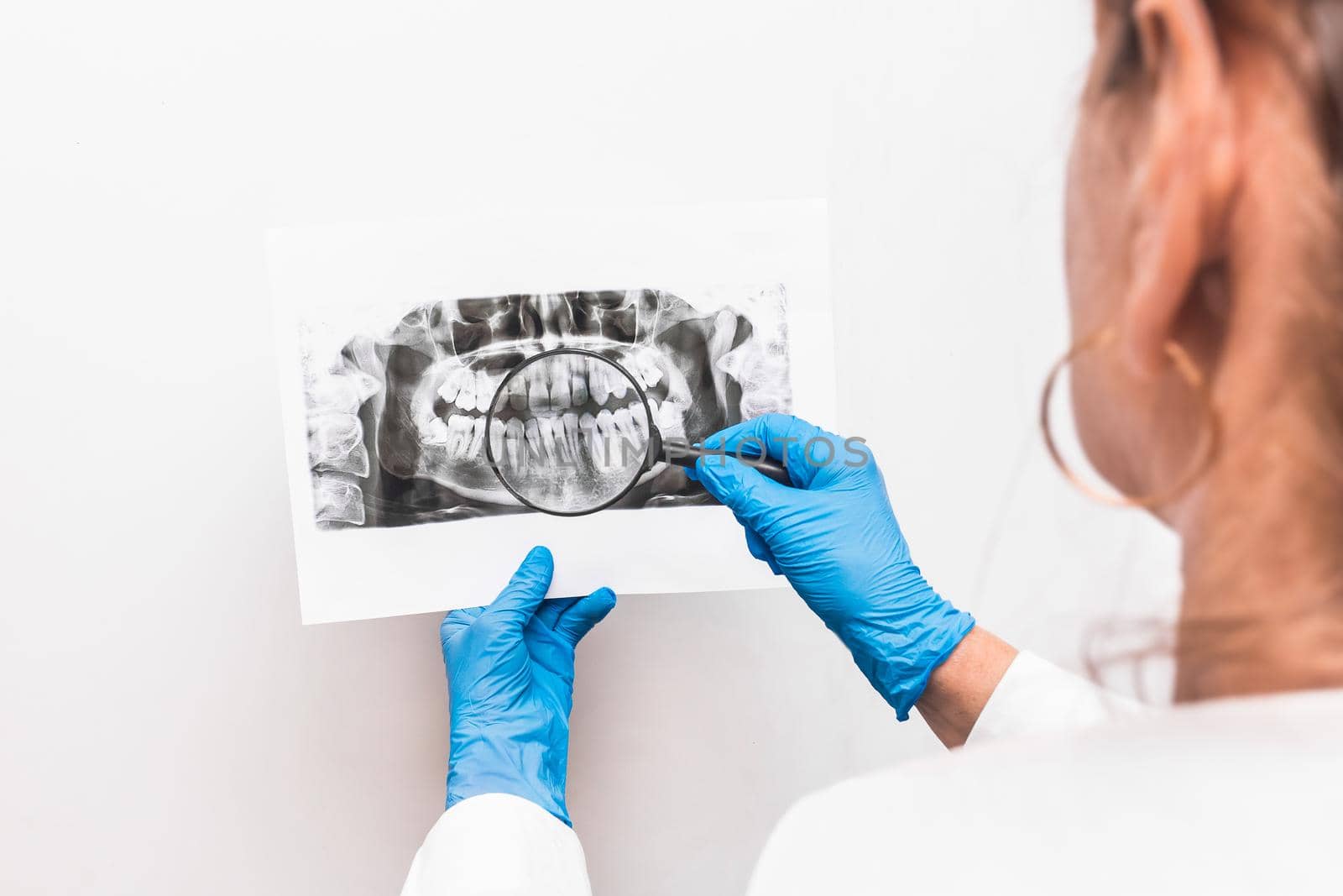 A woman doctor in protective medical gloves holds an X-ray picture of teeth in her hands and examines it through a magnifying glass on a white background, close up.